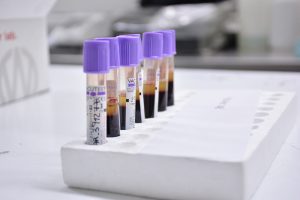 #SomosElEstado: Conocer, donar y salvar vidas desde el sistema de salud de Santa Cruz